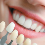 Demystifying Common Misconceptions About Cosmetic Dentistry