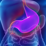 Myths And Facts About Bariatric Surgery