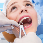 Reasons To Not Be Afraid of A Tooth Extraction